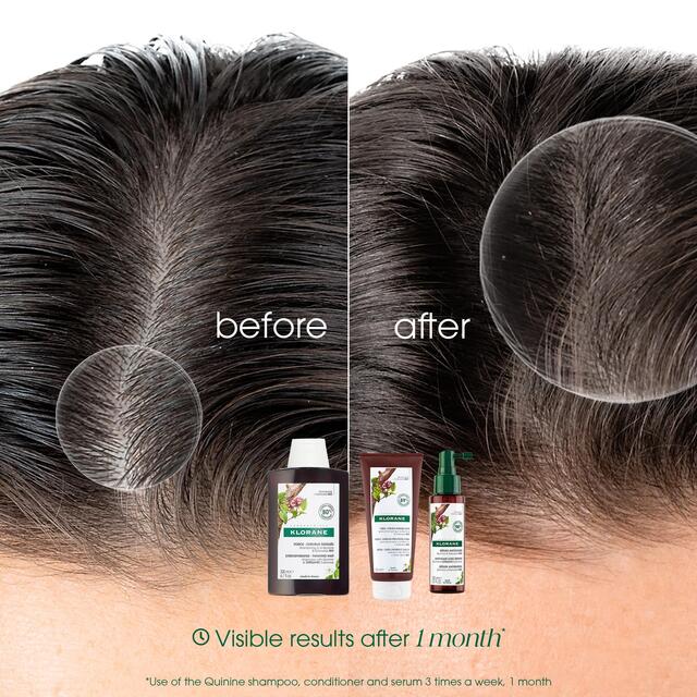 Klorane Shampoo with Quinine and Organic Edelweiss for Thinning Hair 200ml - McGrocer