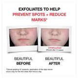 Neutrogena Clear and Defend Serum 10 with AHAPHA Salicylic Acid