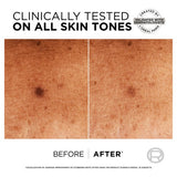 LOreal Paris Bright Reveal DSpot Niaci Ser B30