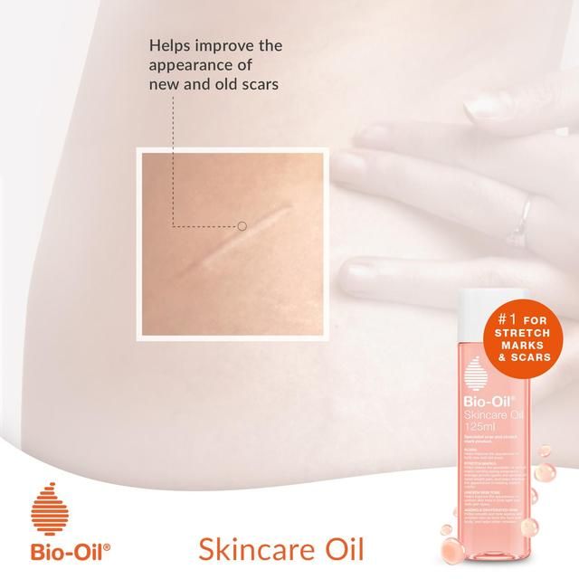 Bio-Oil Skincare 125ml - McGrocer