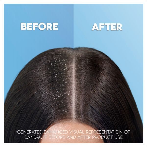 Head&Shoulders Deep Hydration AntiDandruff Shampoo 400ml