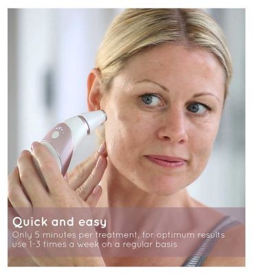 HoMedics Radiance Microdermabrasion