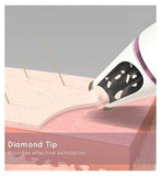 HoMedics Radiance Microdermabrasion