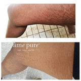 âme pure Body Basic | Stretch Marks 0.75mm - McGrocer
