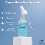 Nature Spell 2% BHA (Salicylic Acid) Liquid Exfoliant 30ml