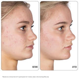 Nip+Fab Retinol Fix Blemish Treatment Gel 10% 15ml