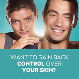 NIVEA Derma Skin Clear Chemical Exfoliator 40ml