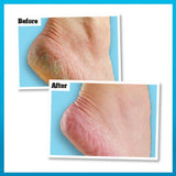 O'Keeffe's Healthy Feet Value Jar 180g