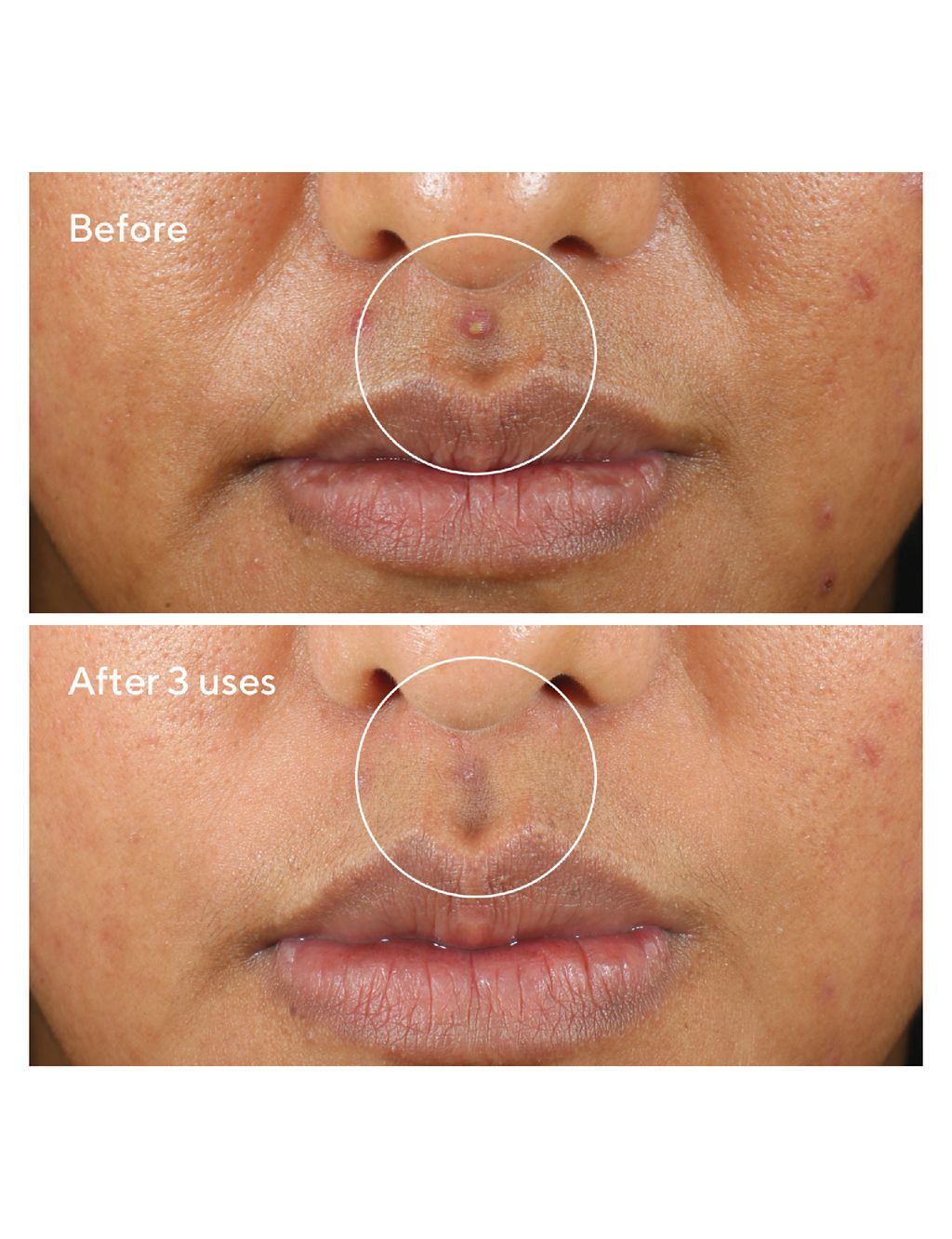 Rapid Relief Sulfur Mask 75ml