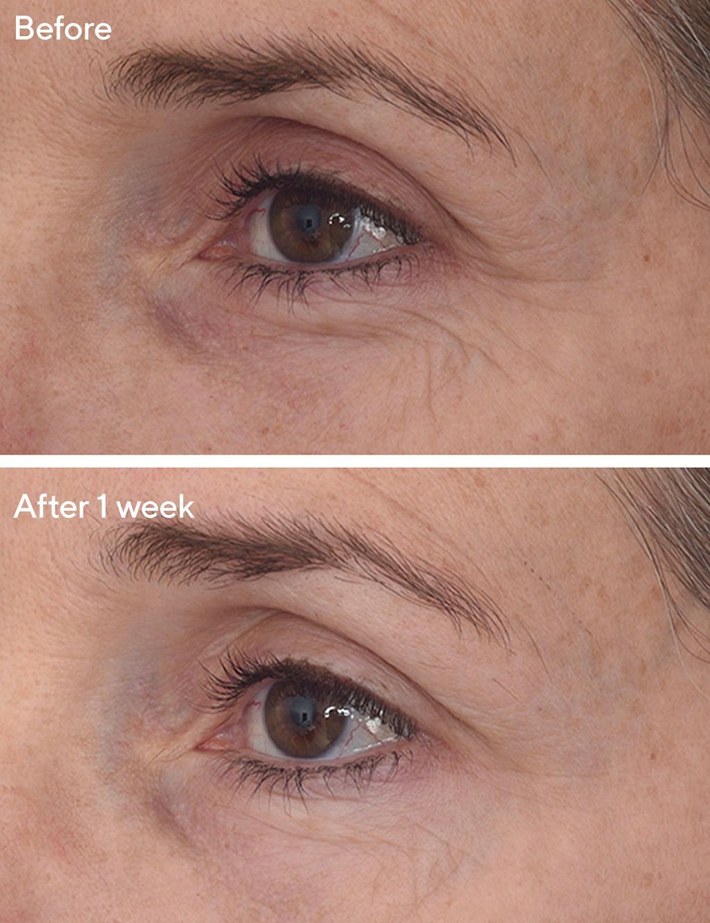 Retinal ReSculpt™ Eye Treatment 15ml