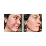 Science of Skin Rescue Acne Scarring 30ml