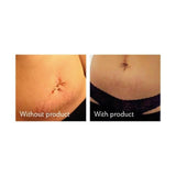 Science of Skin Solution for Stretch Marks 100ml