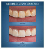 Waterpik Whitening Water Flosser WF-06UK Dental Boots