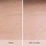 Avon Anew Anti-Wrinkle Smoothing Serum - McGrocer