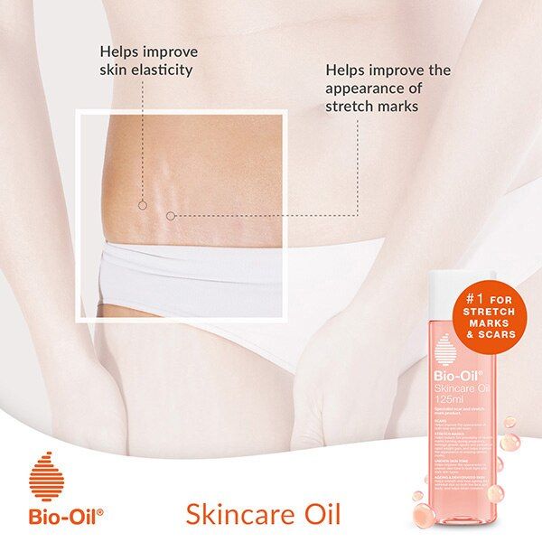 Bio-Oil Skincare Oil For Scars and Stretch Marks 125ml - McGrocer
