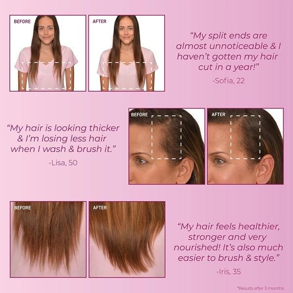 BosleyMD Hair Loss Conditioner MendXtend  300ml - McGrocer