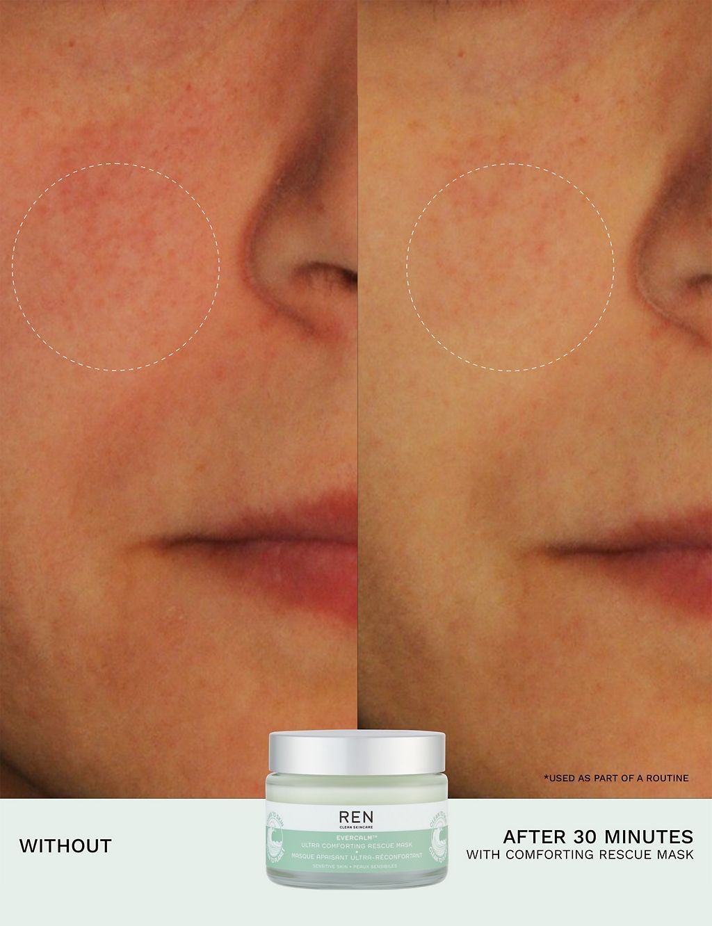 Evercalm&amp;trade; Ultra Comforting Rescue Mask 50ml