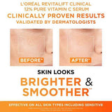 L'Oreal Paris 12% Vitamin C Serum &amp;amp; SPF 50 UV Fluid Duo 50ml