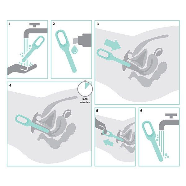 Lovehoney Health Silicone Dilator Set (5)