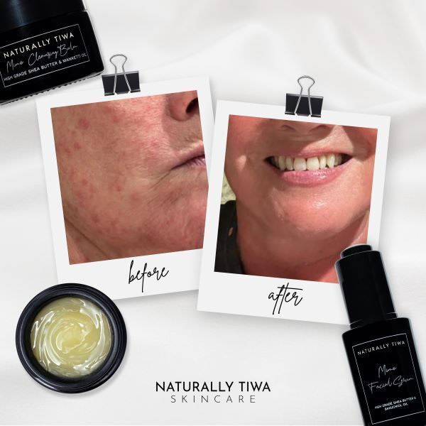 Naturally Tiwa Skincare MIMO Cleansing Balm 40g