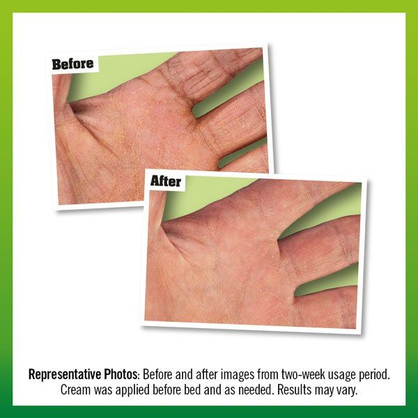 O'Keeffe's Working Hands Overnight 80ml