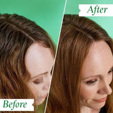 Philip Kingsley Flaky Itchy Regime Kit   190ml