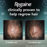 Regaine for Men Extra Strength Hair Regrowth Scalp Foam (1 month supply)