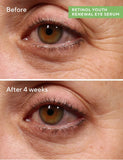 Retinol Youth Renewal Eye Serum 15ml