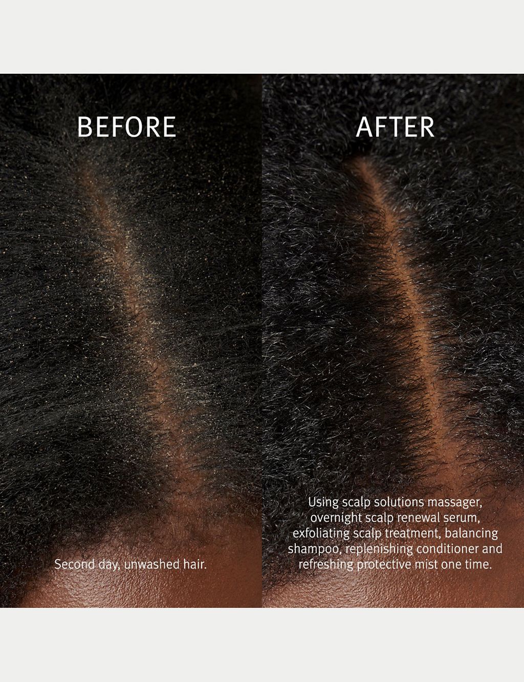 Scalp Solutions Overnight Scalp Renewal Serum (with hyaluronic acid)  50ml