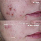 Skin Republic Salicylic Acid 2% Serum   30g